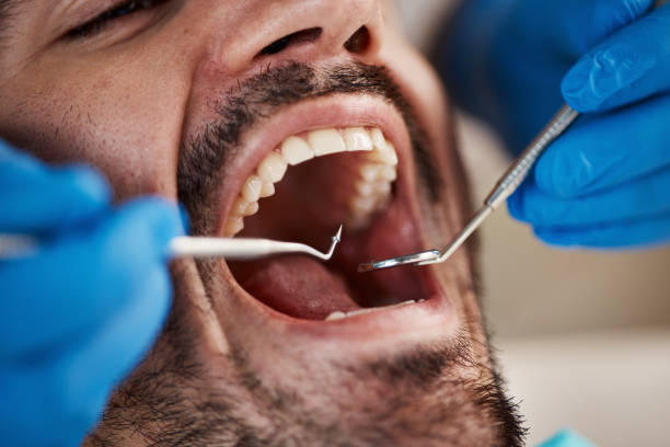 Best Urgent Care for Lost Fillings or Crowns in Destin, FL